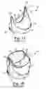 Fig. 02 - Bileaflet prosthetic valve and method of manufacture