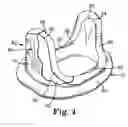 Fig. 04 - Bileaflet prosthetic valve and method of manufacture