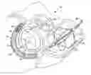 Fig. 01 - Anchor and pull mitral valve device and method