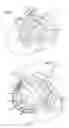 Fig. 02 - Anchor and pull mitral valve device and method