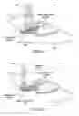 Fig. 07 - Intraocular lens system and method for power adjustment