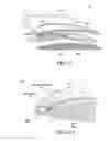 Fig. 08 - Intraocular lens system and method for power adjustment