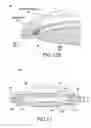 Fig. 09 - Intraocular lens system and method for power adjustment