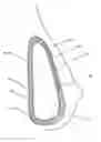 Fig. 01 - Cosmetic and reconstructive prosthesis containing a biologically compatible rupture indicator