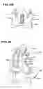 Fig. 09 - Facet arthroplasty devices and methods