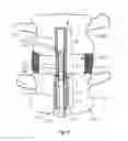 Fig. 16 - Spinal mobility preservation apparatus having an expandable membrane
