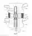 Fig. 17 - Spinal mobility preservation apparatus having an expandable membrane