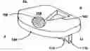 Fig. 01 - Artificial spinal disk replacement device with rotation limiter and lateral approach implantation method