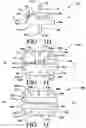 Fig. 05 - Artificial spinal disk replacement device with rotation limiter and lateral approach implantation method