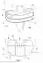Fig. 02 - Multipart component for an orthopaedic implant
