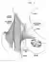 Fig. 02 - Knee prosthesis having a deformable articulation surface
