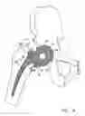 Fig. 05 - Knee prosthesis having a deformable articulation surface