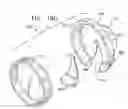 Fig. 23 - Knee prosthesis having a deformable articulation surface