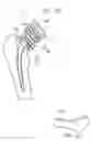 Fig. 29 - Knee prosthesis having a deformable articulation surface
