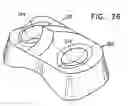 Fig. 34 - Knee prosthesis having a deformable articulation surface