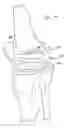 Fig. 35 - Knee prosthesis having a deformable articulation surface