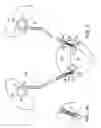 Fig. 05 - Anti-reflux ureteral stents and methods