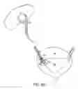 Fig. 11 - Anti-reflux ureteral stents and methods