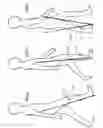 Fig. 02 - Artificial knee joint