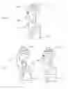 Fig. 08 - Artificial knee joint