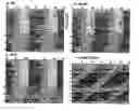 Fig. 01 - Methods for treating circadian rhythm phase disturbances