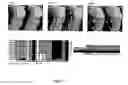 Fig. 08 - Methods for treating circadian rhythm phase disturbances