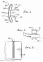 Fig. 02 - Finger guard