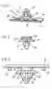 Fig. 02 - Dual durometer clip