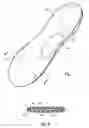 Fig. 06 - Orthopedic device for distributing pressure