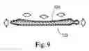 Fig. 07 - Orthopedic device for distributing pressure