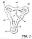 Fig. 04 - Stud earring with a removable dangling element