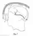 Fig. 02 - Face mask support