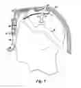 Fig. 06 - Face mask support