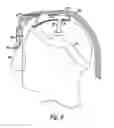 Fig. 07 - Face mask support
