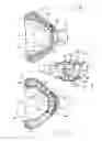 Fig. 03 - Method and device for addressing sleep apnea and related breathing disorders
