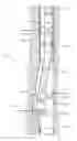 Fig. 01 - Directional cased hole side track method applying rotary closed loop system and casing mill