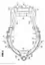 Fig. 04 - Intake apparatus for engine