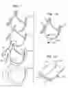 Fig. 02 - Method of manufacture of a heart valve support frame
