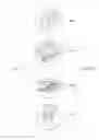 Fig. 07 - Child's cleansing system