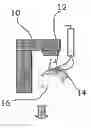 Fig. 01 - Method for performing in vivo dosimetry