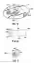 Fig. 08 - Sack-based processes for recovering oil floating on water