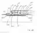 Fig. 07 - Workpiece isothermal imprinting