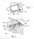 Fig. 03 - Air bag