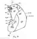 Fig. 04 - Air bag