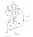 Fig. 08 - Air bag