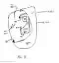 Fig. 10 - Air bag