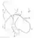 Fig. 06 - Scoop and sheath