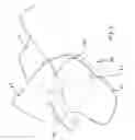Fig. 09 - Scoop and sheath