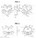 Fig. 04 - Chair with readily removable and replaceable components