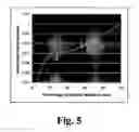 Fig. 06 - Reduced specific absorption ratio T-weighted MRI